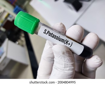 Blood Sample For Serum Potassium Test,part Of Electrolyte Test, Laboratory Background.