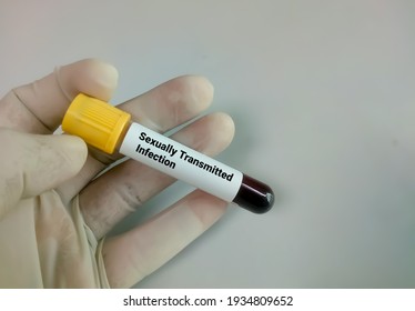 Blood Sample For Sexually Transmitted Infection (STI) Test, STD