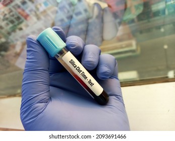 Blood Sample For Silica Clotting Time Test, Phospholipid-dependent Coagulation Assay Used For The Laboratory Diagnosis Of Lupus Anticoagulant (LA) Antibodies.