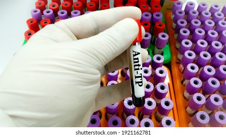 Blood Sample For STI (sexually Transmitted Infection) Anti TP Syphilis Test