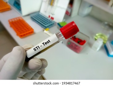 Blood Sample For STI (sexually Transmitted Infection) Test