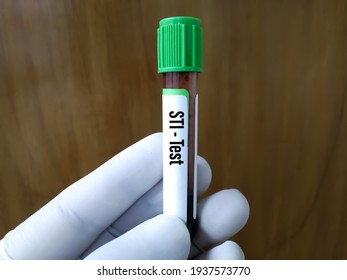 Blood Sample For STI (sexually Transmitted Infection) Test