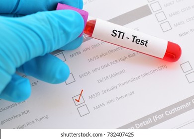 Blood Sample For STI (sexually Transmitted Infection) Test