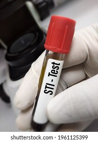 Blood Sample For STI Test, Sexual Transmitted Infection Diagnosis,STD,medical And Healthcare Concept.