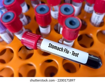 Blood Sample For Stomach Flu(viral Gastroenteritis) Test To Diagnosis Of Gastroenteritis.