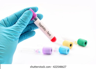 Blood Sample For Syphilis Test