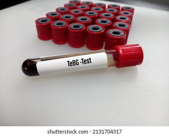 Blood sample for TeBG(Testosterone-estradiol binding globulin) test, SHBG test, sex hormone binding globulin.