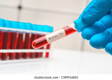 Blood Sample   Test Tube In Doctor Hand For  Melatonin Hormone Test