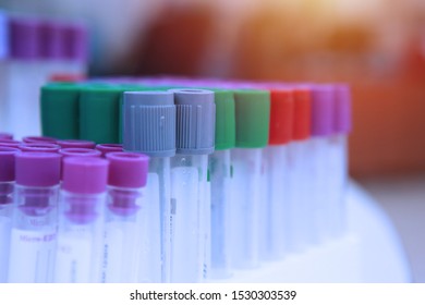 Blood Sample For Testing.Medical Equipment