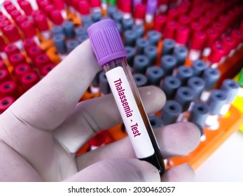 Blood Sample Thalassemia Test Stock Photo 2030462057 | Shutterstock