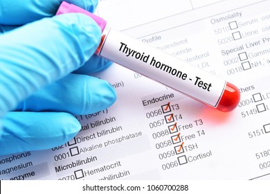 Blood Sample For Thyroid Hormone Test