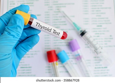 Blood Sample For Thyroid Hormone Test