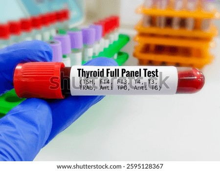 Blood sample for Thyroid panel test including TSH, FT4, FT3, T3, T4, Anti TPO, Anti TG, TR-Ab