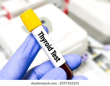 Blood sample for Thyroid test including TSH, FT4, FT3, T3, T4, Anti TPO, Anti TG, TR-Ab