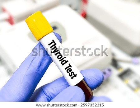 Blood sample for Thyroid test including TSH, FT4, FT3, T3, T4, Anti TPO, Anti TG, TR-Ab