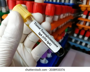 Blood Sample For Tissue Transglutaminase Antibody (tTG) IgA, Diagnosis Of Celiac Disease