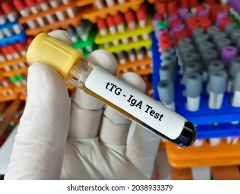 Blood Sample For Tissue Transglutaminase Antibody (tTG) IgA, Diagnosis Of Celiac Disease