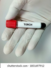 Blood Sample For TORCH Test.  TORCH Panel