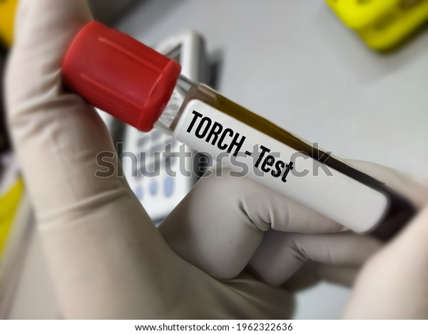 Blood Sample Torch Testtorch Panel Test Stock Photo 1962322636 ...