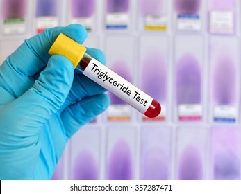 Blood Sample For Triglyceride Test