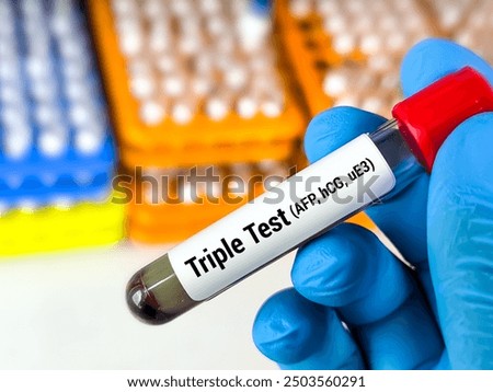 Blood sample for Triple test (AFP +eU3 + hCG)