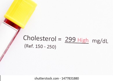 Blood Sample Abnormal High Triglyceride Test Stock Photo (Edit Now ...