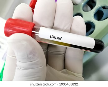 Blood Sample Tube With Abnormal High Uric Acid Test Result