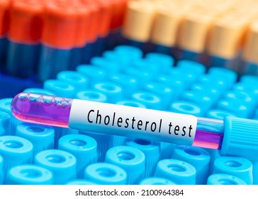 Blood Sample Tube With Abnormal High Cholesterol Test