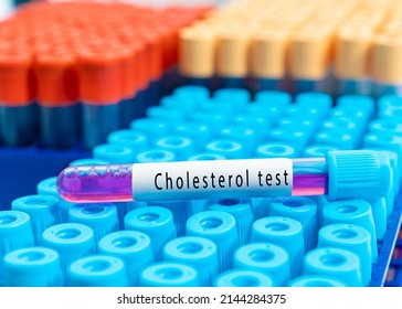 Blood Sample Tube With Abnormal High Cholesterol Test