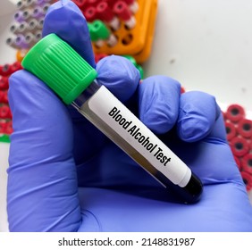 Blood Sample Tube Blood Alcohol Test Stock Photo 2148831987 | Shutterstock