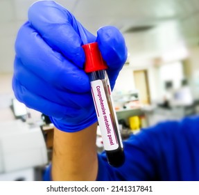 Blood Sample Tube For Analysis Of CMP Or Comprehensive Metabolic Panel In Laboratory.