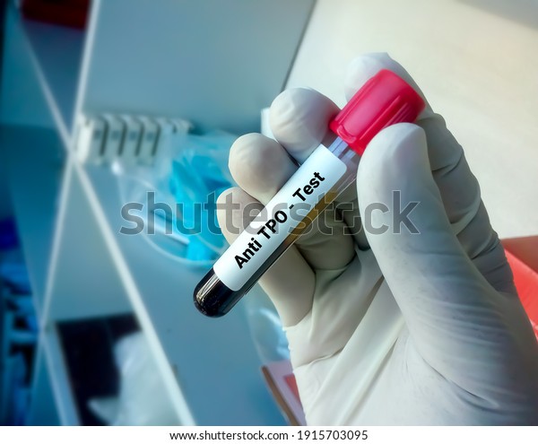 Blood Sample Tube Anti Tpo Antithyroid Stock Photo 1915703095 ...