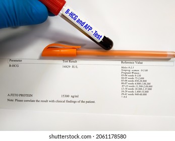 Blood Sample Tube Bhcg Alphafetoprotein Afp Stock Photo 2061178580 ...