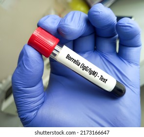 Blood sample tube for Borrelia IgG and IgM test, Lyme disease diagnosis.