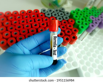 Blood sample tube for Borrelia test, Lyme disease diagnosis