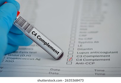 
Blood sample tube for C4 complement test analysis.