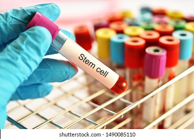 Blood Sample Tube Contain With Stem Cell