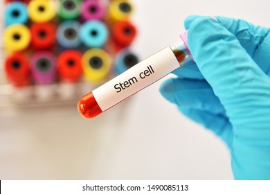 Blood Sample Tube Contain With Stem Cell