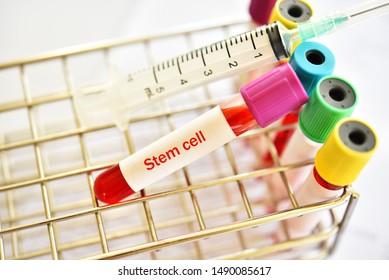 Blood Sample Tube Contain With Stem Cell