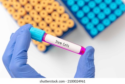 Blood Sample Tube Contain  Stem Cells For Cell Therapy Blood Sample In Test Tube On Doctor Hand In Medical Lab