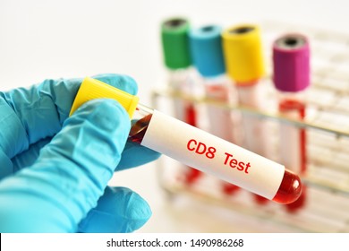 Blood Sample Tube Leukemia Cells Test Stock Photo 1524564458 | Shutterstock