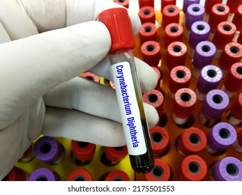 Blood Sample Tube For Diphtheria Test. Diphtheria Is A Potentially Deadly Infection Caused By Toxins Produced By Certain Strains Of Corynebacterium Bacteria. Which Is Back Australia 