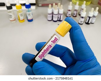 Blood Sample Tube For Diphtheria Test. Diphtheria Is A Potentially Deadly Infection Caused By Toxins Produced By Certain Strains Of Corynebacterium Bacteria. Which Is Back Australia 