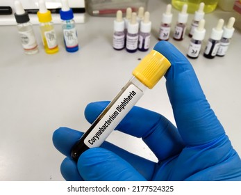 Blood Sample Tube For Diphtheria Test. Diphtheria Is A Potentially Deadly Infection Caused By Toxins Produced By Certain Strains Of Corynebacterium Bacteria.