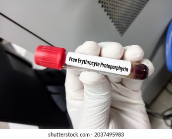Blood Sample Tube Free Erythrocyte Protoporphyrin Stock Photo Blood Sample Tube Free Erythrocyte Protoporphyrin Stock Photo