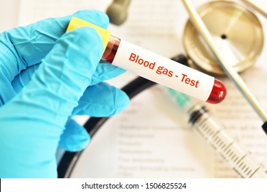 77 Arterial Blood Gas Analysis Images, Stock Photos & Vectors ...