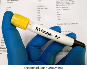 Blood Sample Tube For Hepatitis C Virus (HCV) Genotype Test