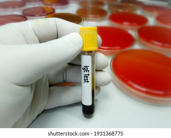 Blood Sample Tube For Immunoglobulin E Or IgE Level Test, Diagnosis For Allergy Disease