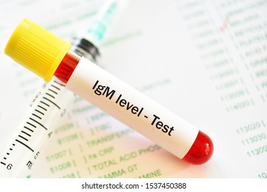 Blood Sample Tube For Immunoglobulin M Or IgM Level Test, Diagnosis For Immunodeficiency Disease