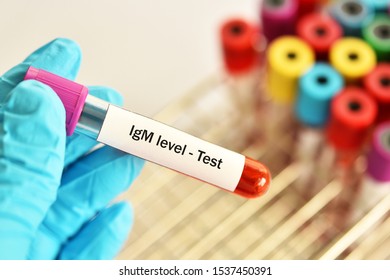 Blood Sample Tube For Immunoglobulin M Or IgM Level Test, Diagnosis For Immunodeficiency Disease